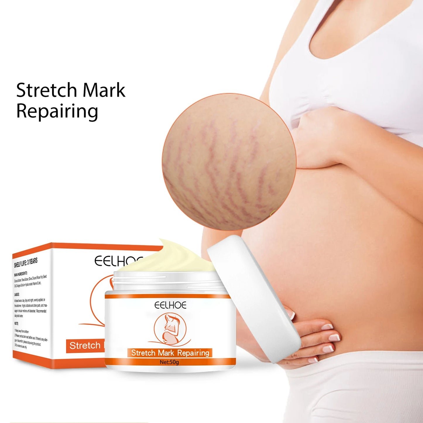 Stretch Marks Removal Cream – Anti-Aging & Skin Firming Body Treatment