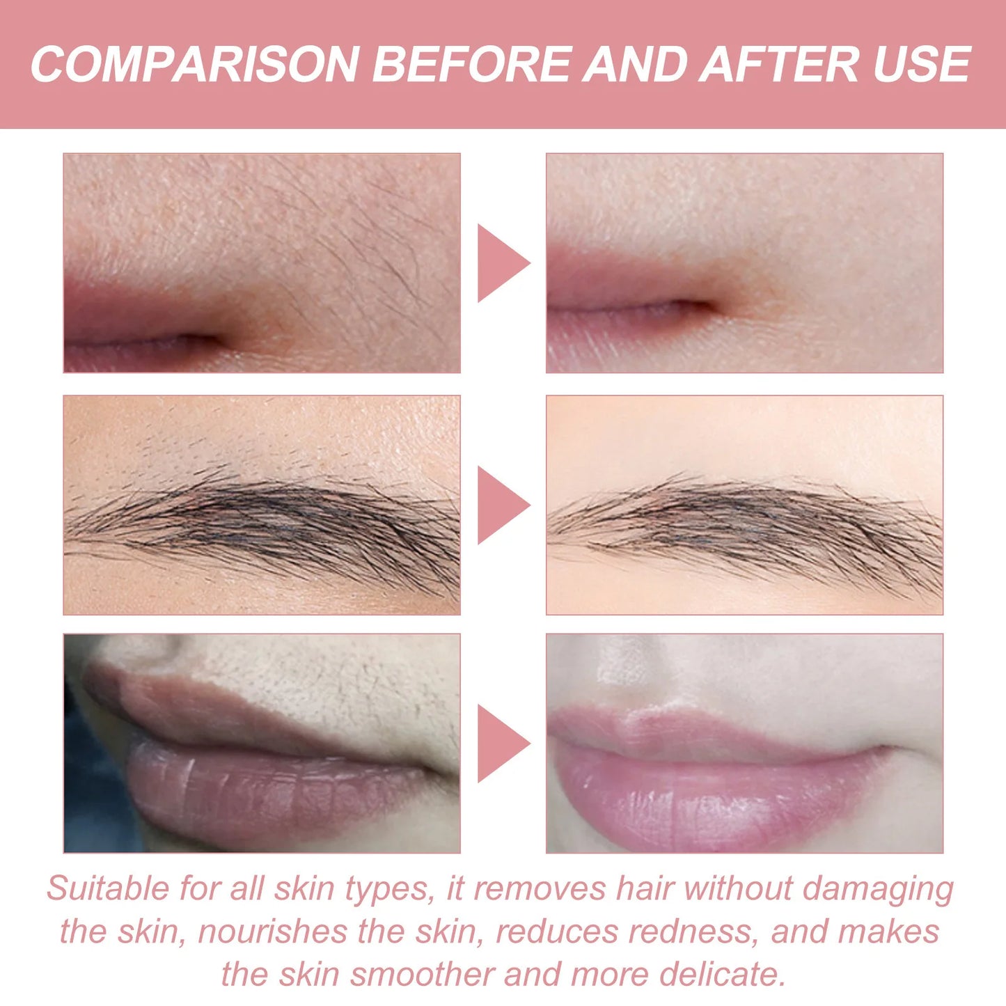 Painless Hair Removal Cream – Gentle, Fast, and Nourishing
