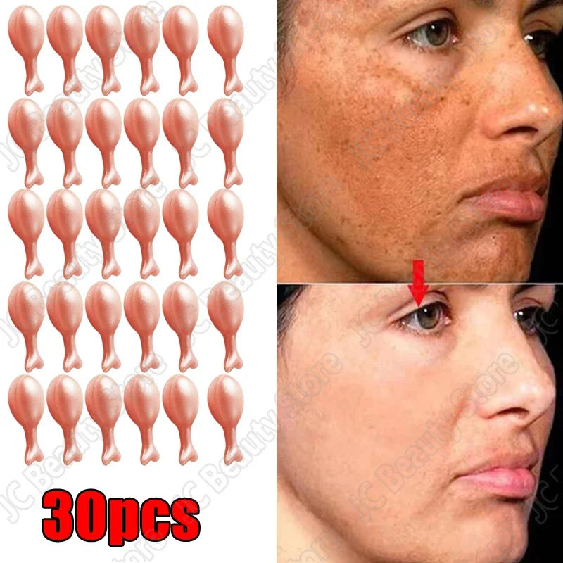 Freckle & Dark Spot Corrector Serum – Anti-Pigmentation Whitening with Hyaluronic Acid (Korean Skincare)