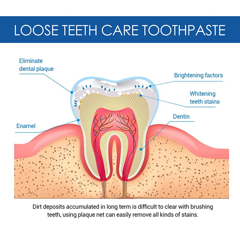 Whitening Teeth Toothpaste – Dental Calculus Remover & Fresh Breath Care