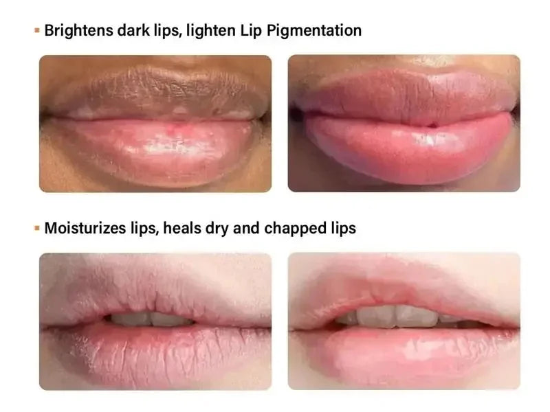 Korean Cosmetics Lightening Lip Balm – Restore Natural Pink, Moisturized Lips