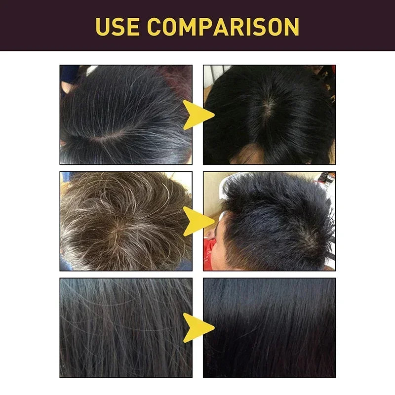 100ml Herbal Black Hair Dye Shampoo – 3-in-1 Instant Color, Cleanser & Conditioner