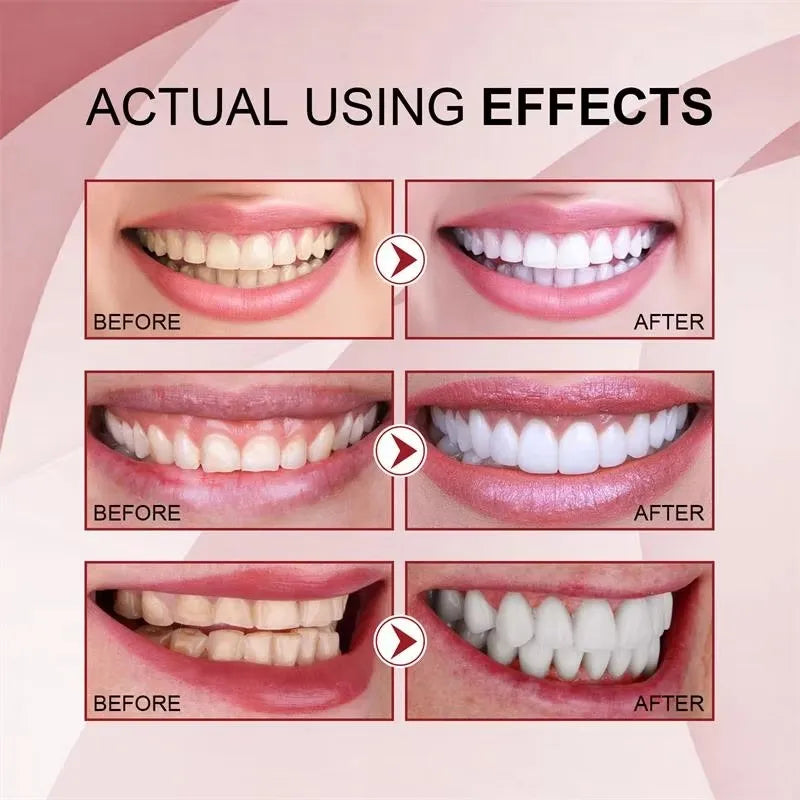 Whitening Teeth Toothpaste – Dental Calculus Remover & Fresh Breath Care