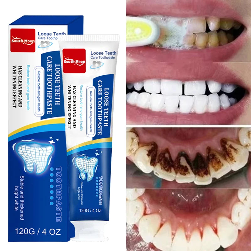 Whitening Teeth Toothpaste – Dental Calculus Remover & Fresh Breath Care