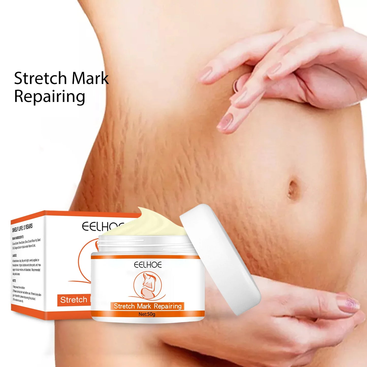 Stretch Marks Removal Cream – Anti-Aging & Skin Firming Body Treatment