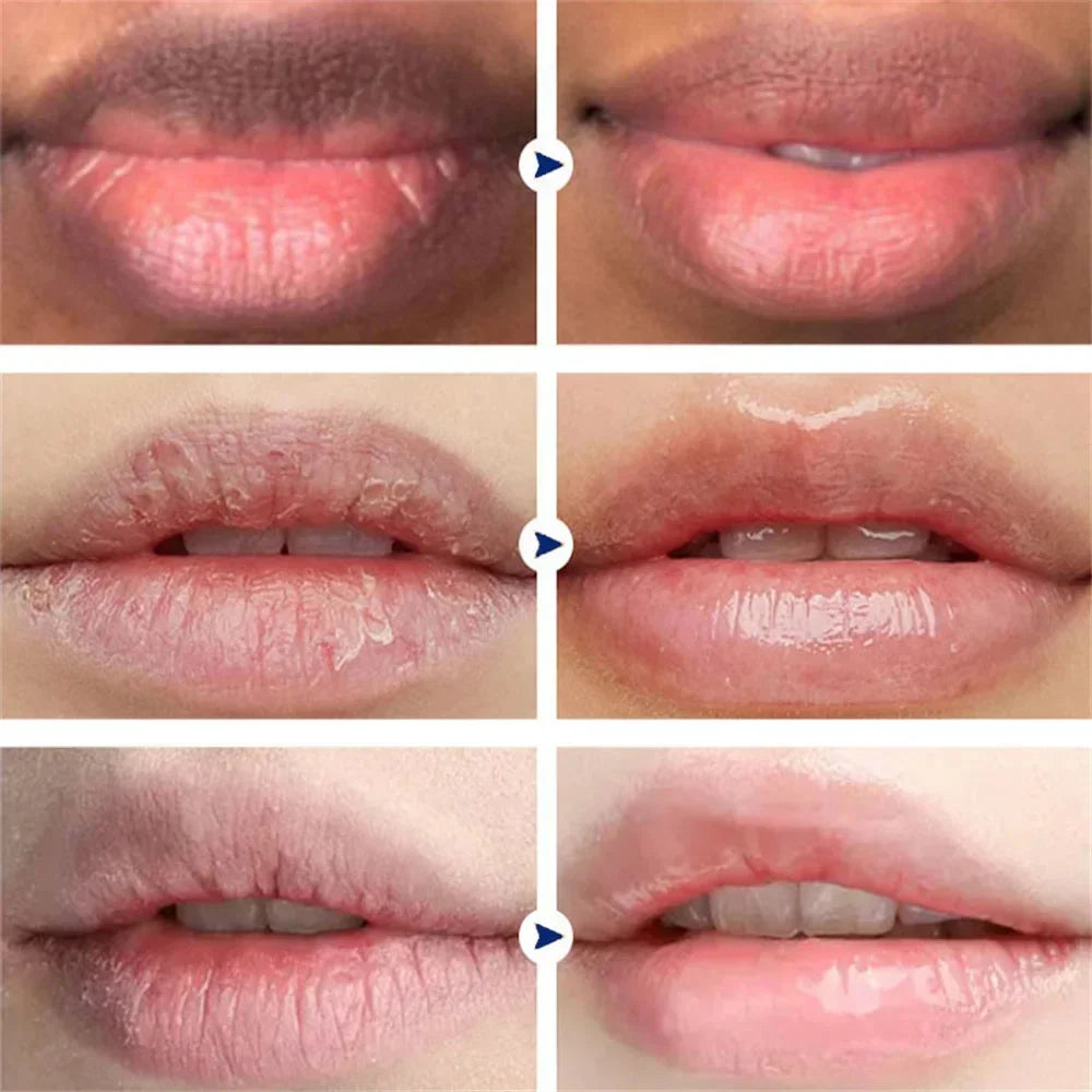 Korean Cosmetics Lightening Lip Balm – Restore Natural Pink, Moisturized Lips