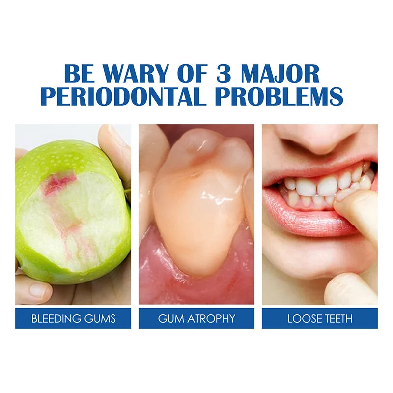 Whitening Teeth Toothpaste – Dental Calculus Remover & Fresh Breath Care