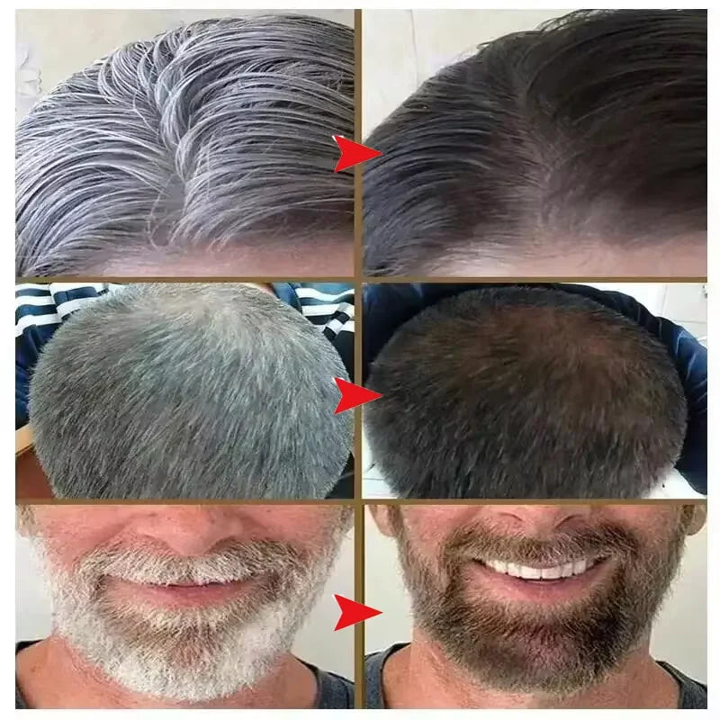 Natural Darkening Shampoo Bar – Restore Gray Hair & Beard to Black | Herbal Anti-Gray Hair Soap (50g)