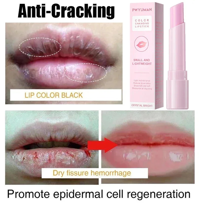 Korean Cosmetics Lightening Lip Balm – Restore Natural Pink, Moisturized Lips