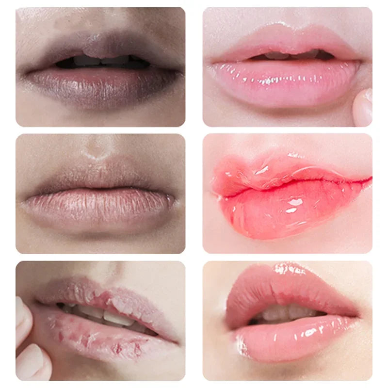 Lightening Lip Balm for Dark Lips – Moisturizing, Brightening, and Plumping