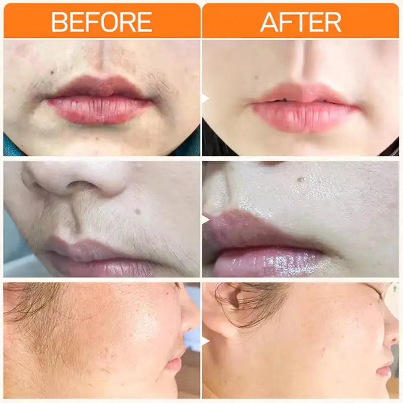 Painless Hair Removal Cream – Gentle, Fast, and Nourishing
