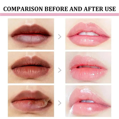 Remove Dark Lip Balm Fast Lightening Pink Lip Exfoliating Fade Lip Line Dead Skin Moisturizer Korean Care Products Beauty Health