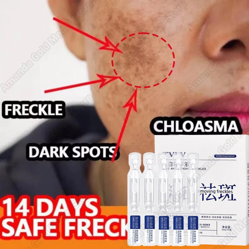 Whitening Freckle Serum – Correct Dark Spots, Brighten Skin, and Hydrate Deeply
