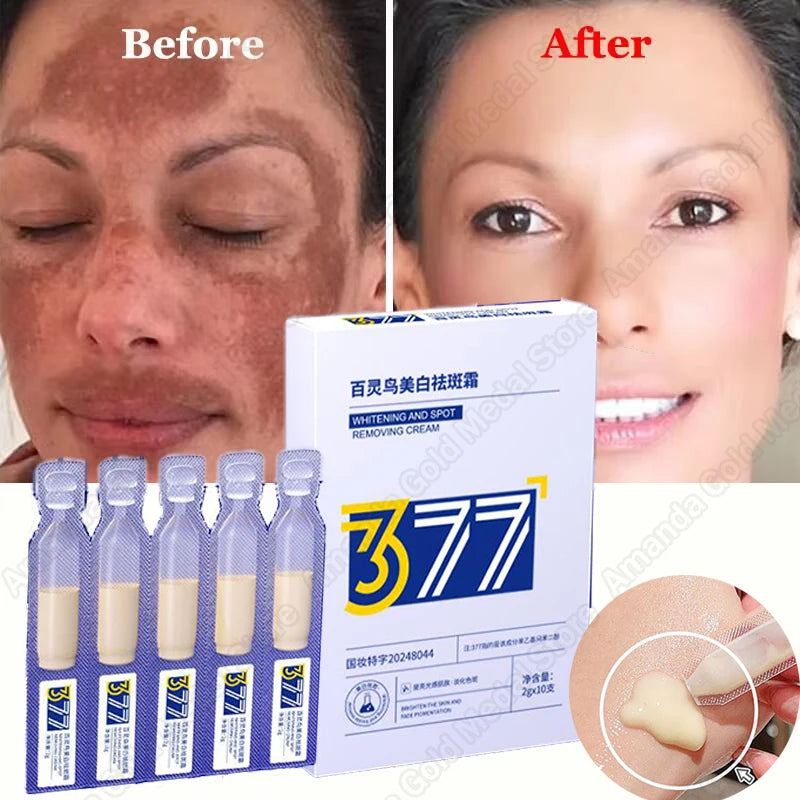 Whitening Freckle Serum – Correct Dark Spots, Brighten Skin, and Hydrate Deeply