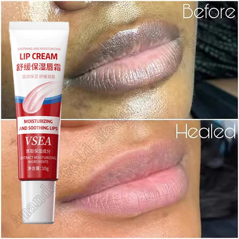 Remove Dark Lip Balm Fast Lightening Pink Lip Exfoliating Fade Lip Line Dead Skin Moisturizer Korean Care Products Beauty Health