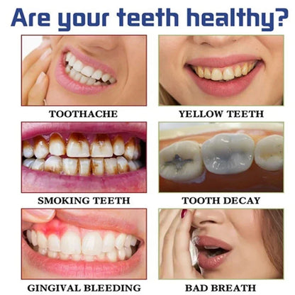 V34 Purple Whitening Toothpaste – Color Correcting Enzyme Mousse for Stains & Yellow Teeth (50g)