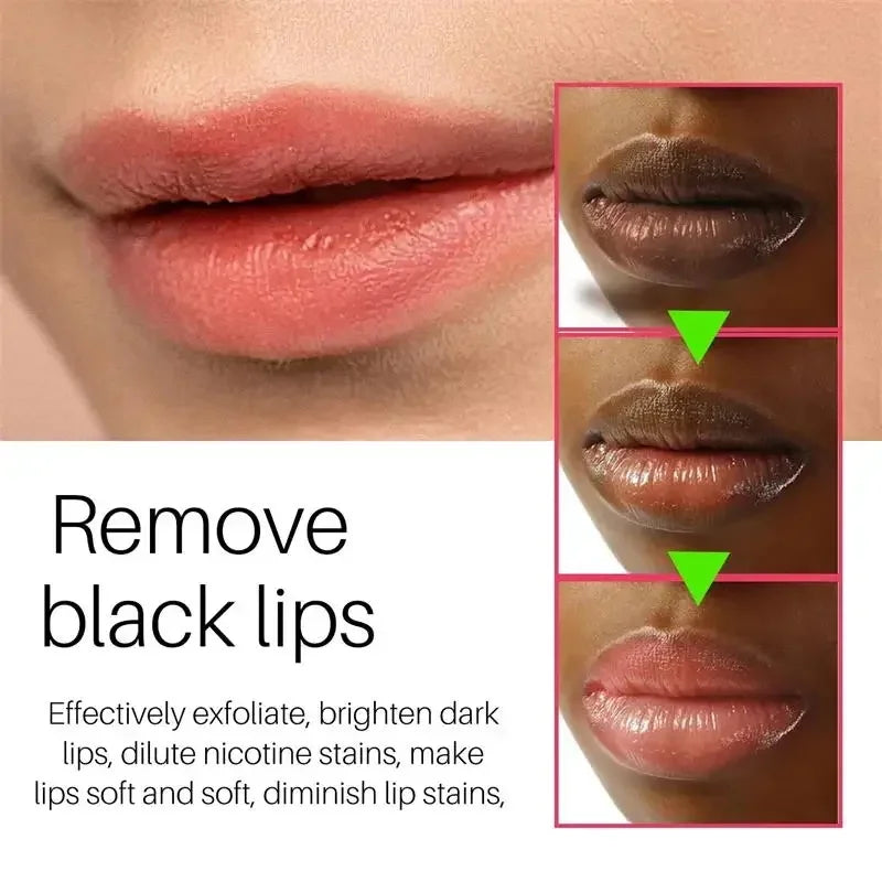 Remove Dark Smoke Lip Balm