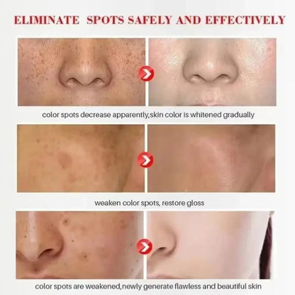 Whitening Freckle Serum – Correct Dark Spots, Brighten Skin, and Hydrate Deeply
