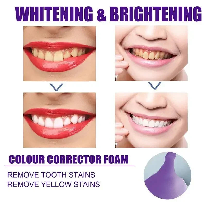 V34 Purple Whitening Toothpaste – Color Correcting Enzyme Mousse for Stains & Yellow Teeth (50g)