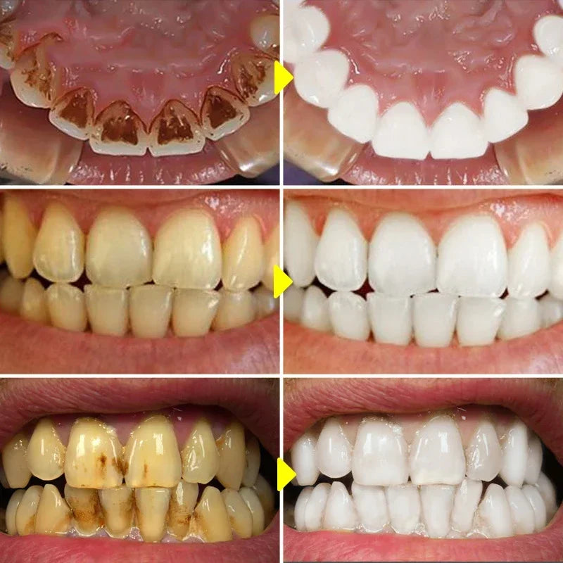 V34 Purple Whitening Toothpaste – Color Correcting Enzyme Mousse for Stains & Yellow Teeth (50g)