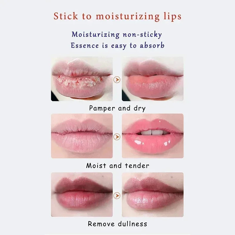 Remove Dark Lip Balm Fast Lightening Pink Lip Exfoliating Fade Lip Line Dead Skin Moisturizer Korean Care Products Beauty Health