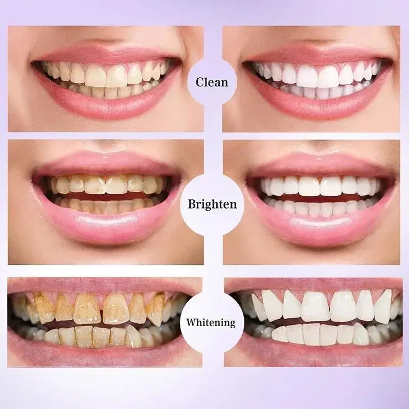 V34 Purple Whitening Toothpaste – Color Correcting Enzyme Mousse for Stains & Yellow Teeth (50g)
