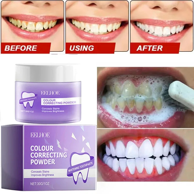 5 Days Teeth Whitening Powder Remove Plaque Stains Dental Calculus Oral Hygiene Cleaning Fresh Bad Breath Tooth Care Products