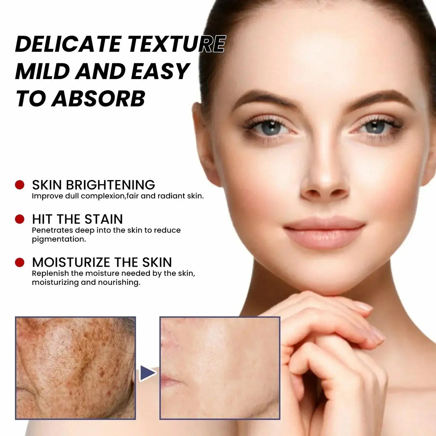 Whitening Freckle Serum – Correct Dark Spots, Brighten Skin, and Hydrate Deeply