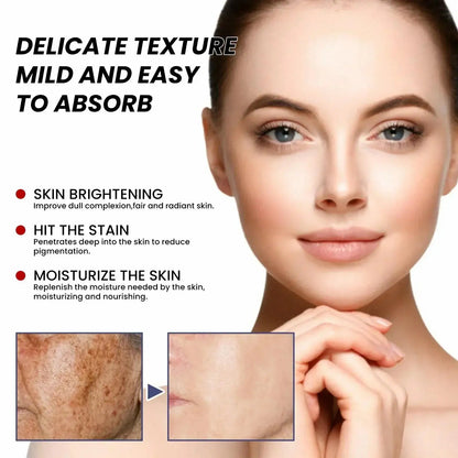 Whitening Freckle Serum – Correct Dark Spots, Brighten Skin, and Hydrate Deeply