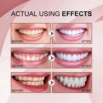 Whitening Teeth Toothpaste – Dental Calculus Remover & Fresh Breath Care
