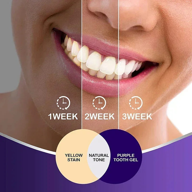 V34 Purple Whitening Toothpaste – Color Correcting Enzyme Mousse for Stains & Yellow Teeth (50g)