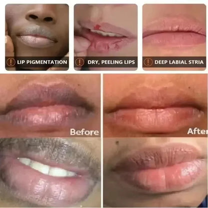Remove Dark Smoke Lip Balm