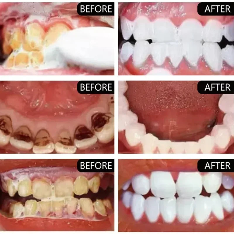 V34 Purple Whitening Toothpaste – Color Correcting Enzyme Mousse for Stains & Yellow Teeth (50g)