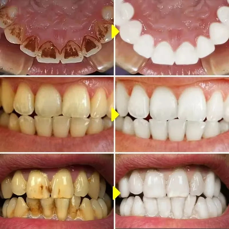V34 Purple Whitening Toothpaste – Color Correcting Enzyme Mousse for Stains & Yellow Teeth (50g)
