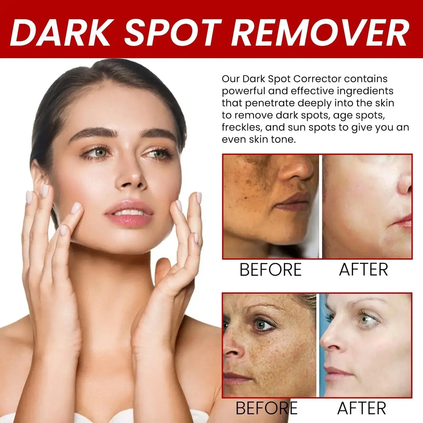 Whitening Freckle Serum – Correct Dark Spots, Brighten Skin, and Hydrate Deeply