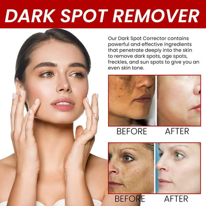 Whitening Freckle Serum – Correct Dark Spots, Brighten Skin, and Hydrate Deeply