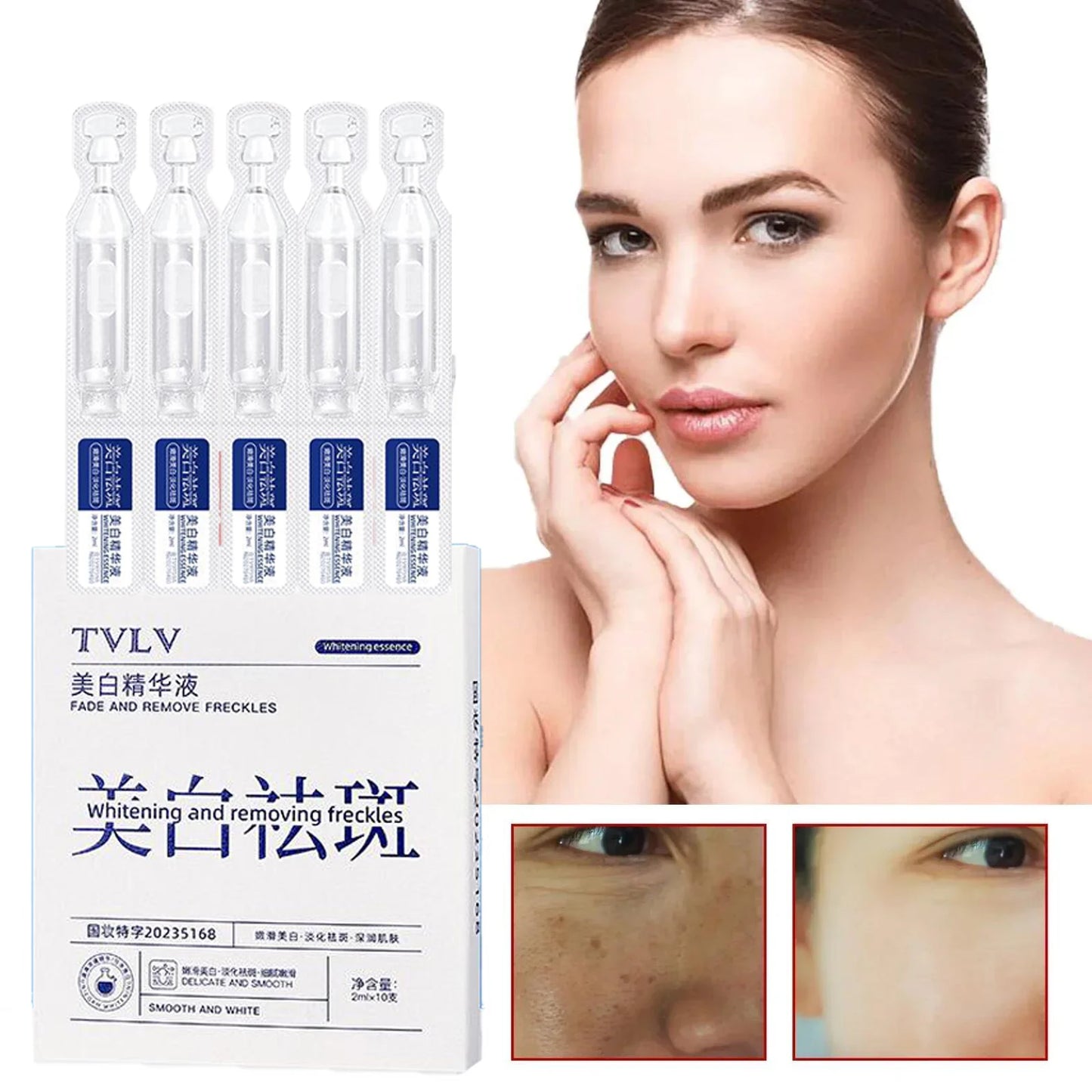Whitening Freckle Serum – Correct Dark Spots, Brighten Skin, and Hydrate Deeply
