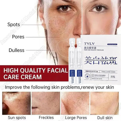 Whitening Freckle Serum – Correct Dark Spots, Brighten Skin, and Hydrate Deeply