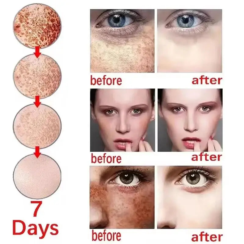Whitening Freckle Serum – Correct Dark Spots, Brighten Skin, and Hydrate Deeply
