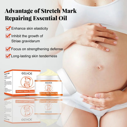 Stretch Marks Removal Cream – Anti-Aging & Skin Firming Body Treatment