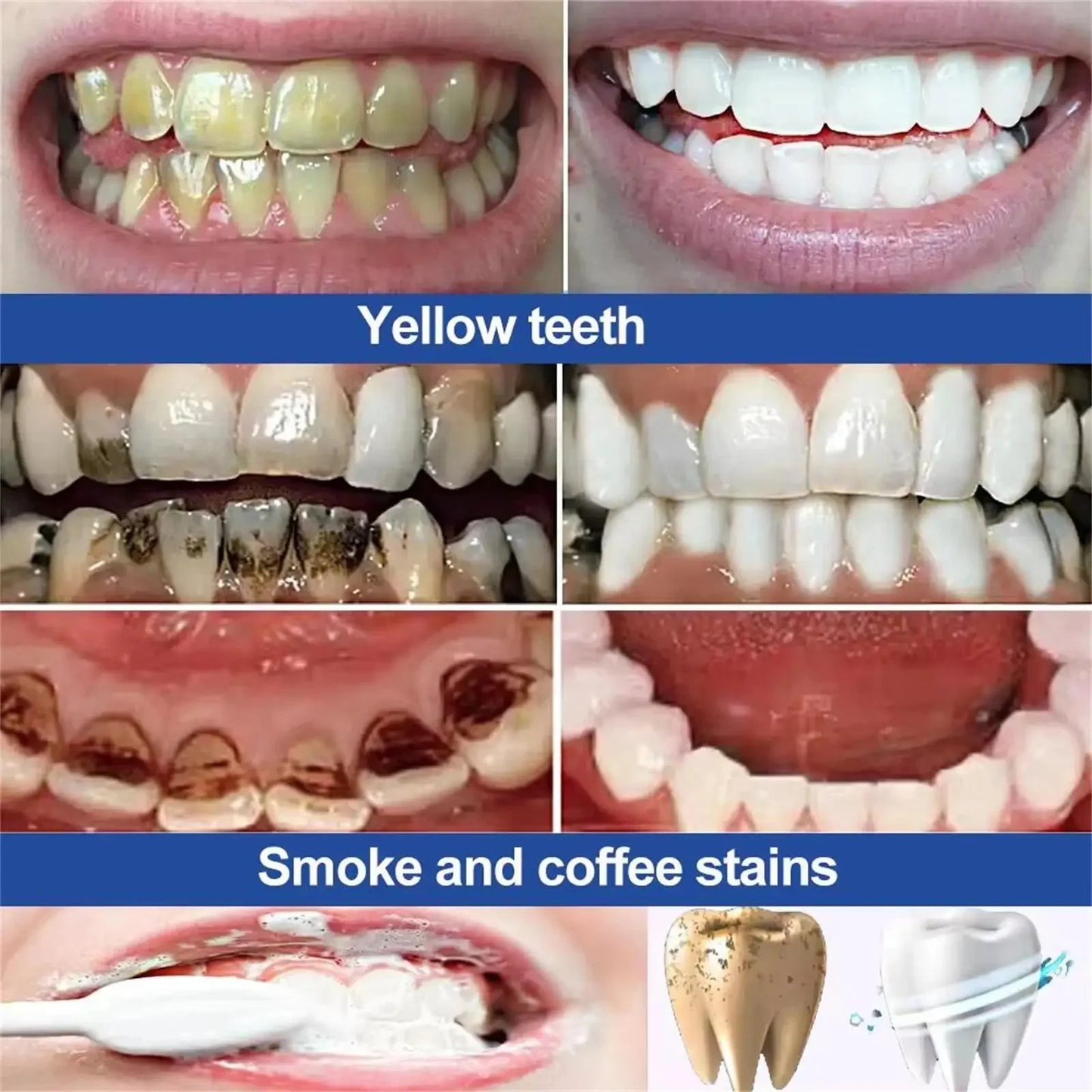 5 Days Teeth Whitening Powder Remove Plaque Stains Dental Calculus Oral Hygiene Cleaning Fresh Bad Breath Tooth Care Products