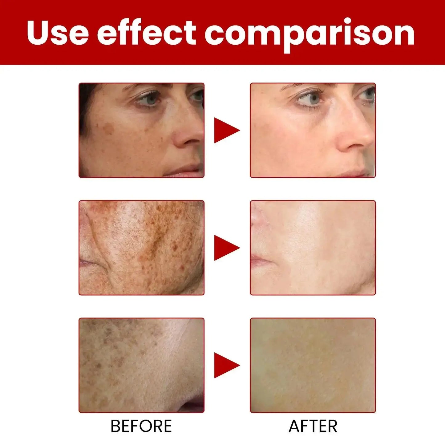 Whitening Freckle Serum – Correct Dark Spots, Brighten Skin, and Hydrate Deeply