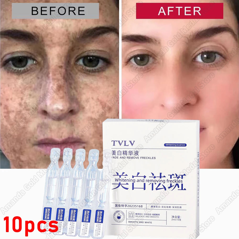 Whitening Freckle Serum – Correct Dark Spots, Brighten Skin, and Hydrate Deeply