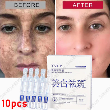 Whitening Freckle Serum – Correct Dark Spots, Brighten Skin, and Hydrate Deeply