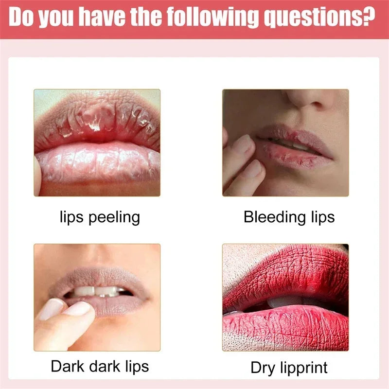 Fast Lightening Lip Bleaching Serum