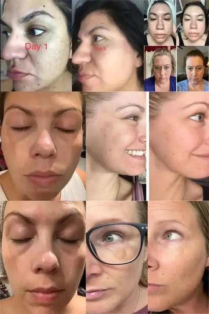 Whitening Freckle Serum – Correct Dark Spots, Brighten Skin, and Hydrate Deeply